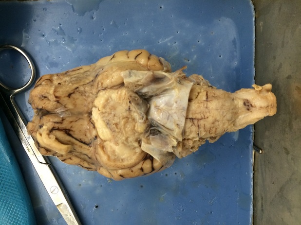 Inferior View Of Sheep Brain